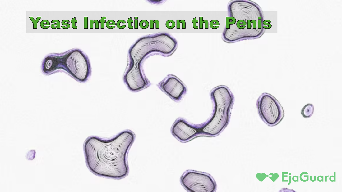 Yeast Infection on the Penis: Causes, Symptoms, and Fast Relief Tips for Men