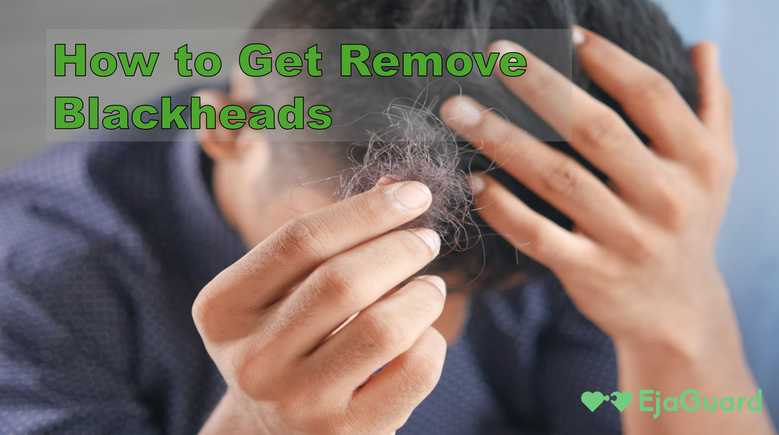 How to Get Remove Blackheads: Natural Remedies, Tips & Treatments That Work