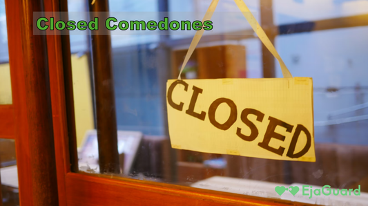 Closed Comedones: Causes, Treatment, and How to Prevent Them Naturally