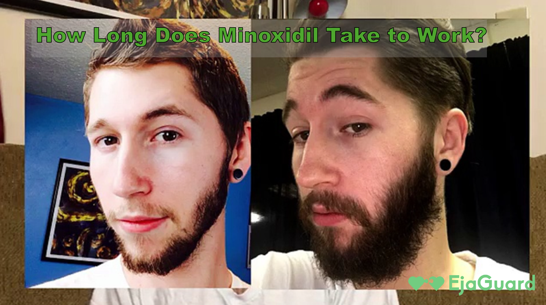 How Long Does Minoxidil Take to Work? Full Timeline & Tips